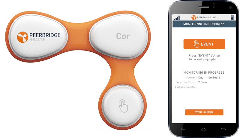 News Two Companies Colloborate on a New Combined Solution to More Efficiently & Effectively Diagnose & Treat AFib & POAF reported by Medical Device News Magazine