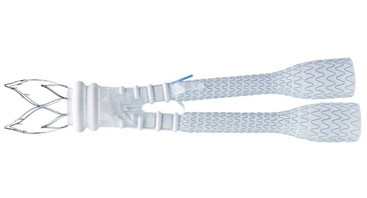 Alto Abdominal Stent Graft System