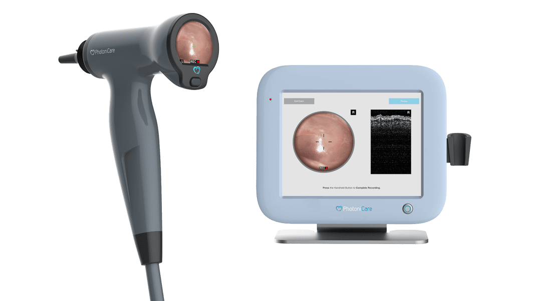 PhotoniCare TOMiScope image.