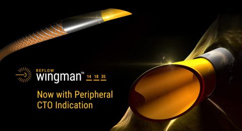 Reflow Medical Wingman Catheter