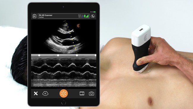 Clarius PA HD is now available for high resolution cardiac imaging with the release of the Clarius Ultrasound App 7.3.0