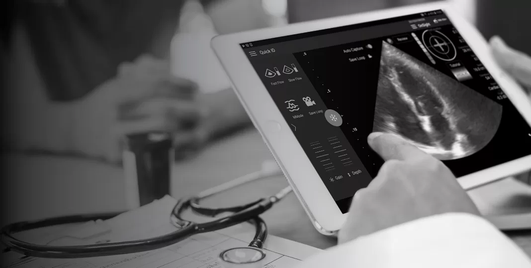 UltraSight Raises $13 million to Bring AI Guidance for Cardiac Ultrasound to Patient Point of Care