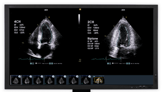 Circle Cardiovascular Imaging Inc. and DiA Imaging Analysis Partnership