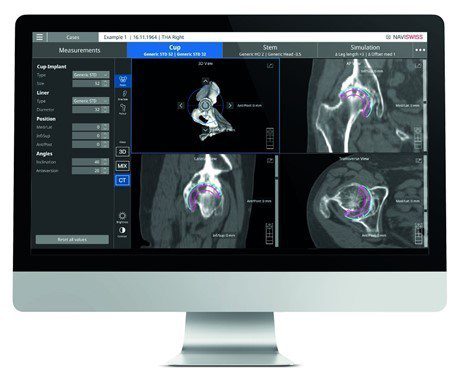 Naviswiss Receives FDA 510k Clearance for Naviplan