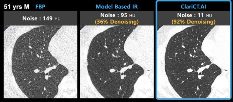 News ClariPi to Showcase its AI Medical Imaging Solutions at RSNA 2021