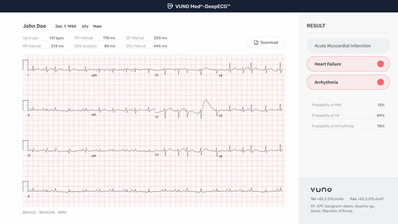 News VUNO Med®-DeepECG™ Designated as Breakthrough Device 