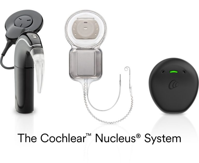 FDA Approves Cochlear Nucleus Implants for Unilateral Hearing Loss/single-sided Deafness