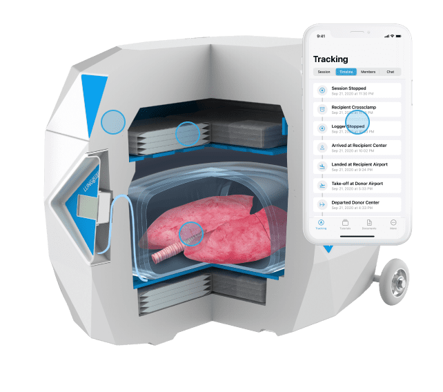 LUNGguard System