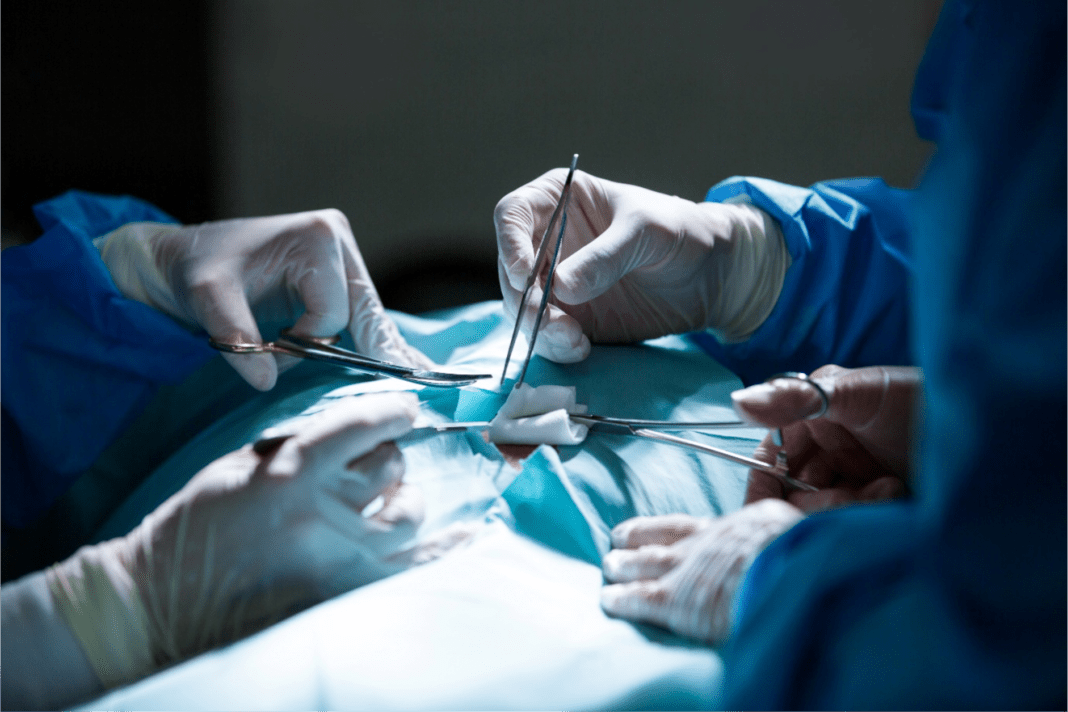 Major Categories and Types of Commonly Used Surgical Instruments