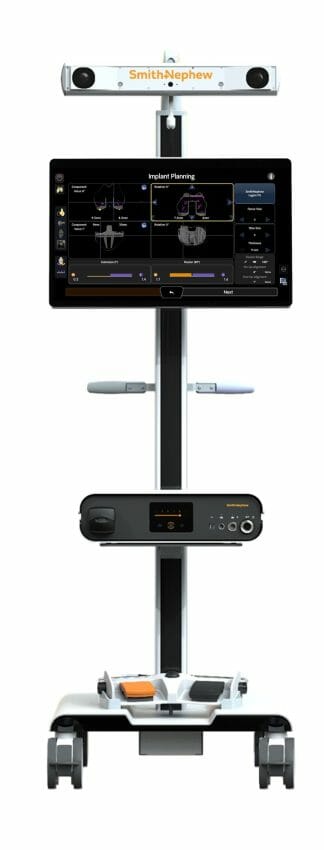 Smith+Nephew first to market with revision knee indication on robotics platform 