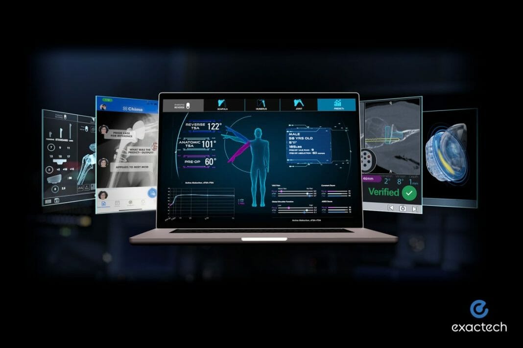 US Patent Issued for Exactech's Predict+™, First Machine Learning-Based Software that Informs Surgeons with Patient-Specific Outcome Predictions after Shoulder Replacement Surgery