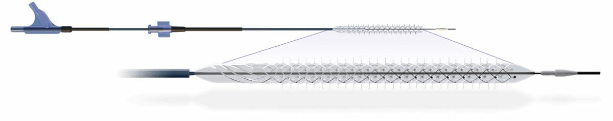 irst Patient Enrolled in Reflow Medical’s DEEPER REVEAL IDE Clinical Study