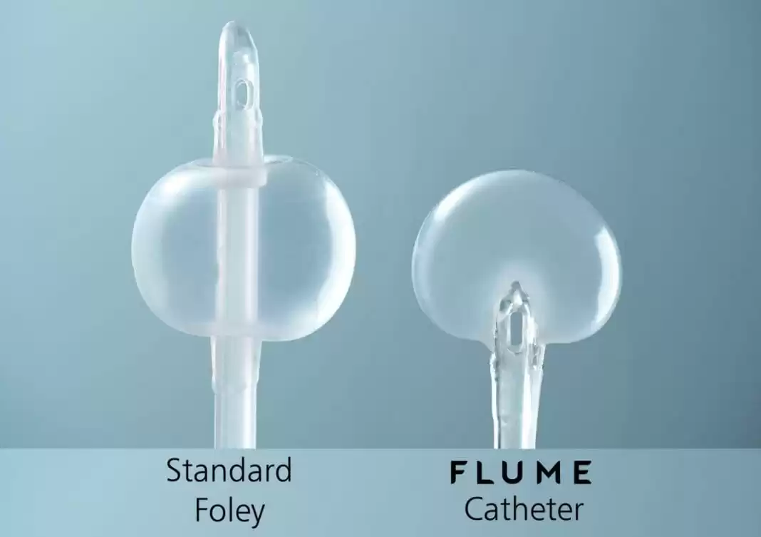 FLUME Catheter