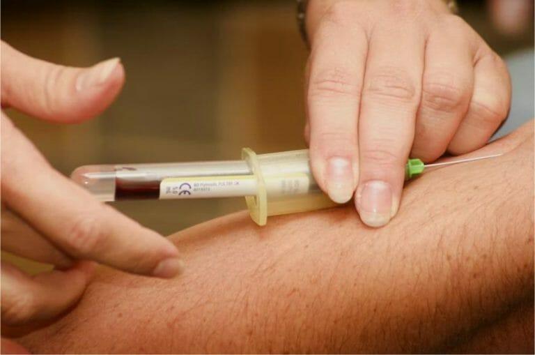 Top 12 Crucial Blood Tests: What They Show & How Often You Should Take Them!