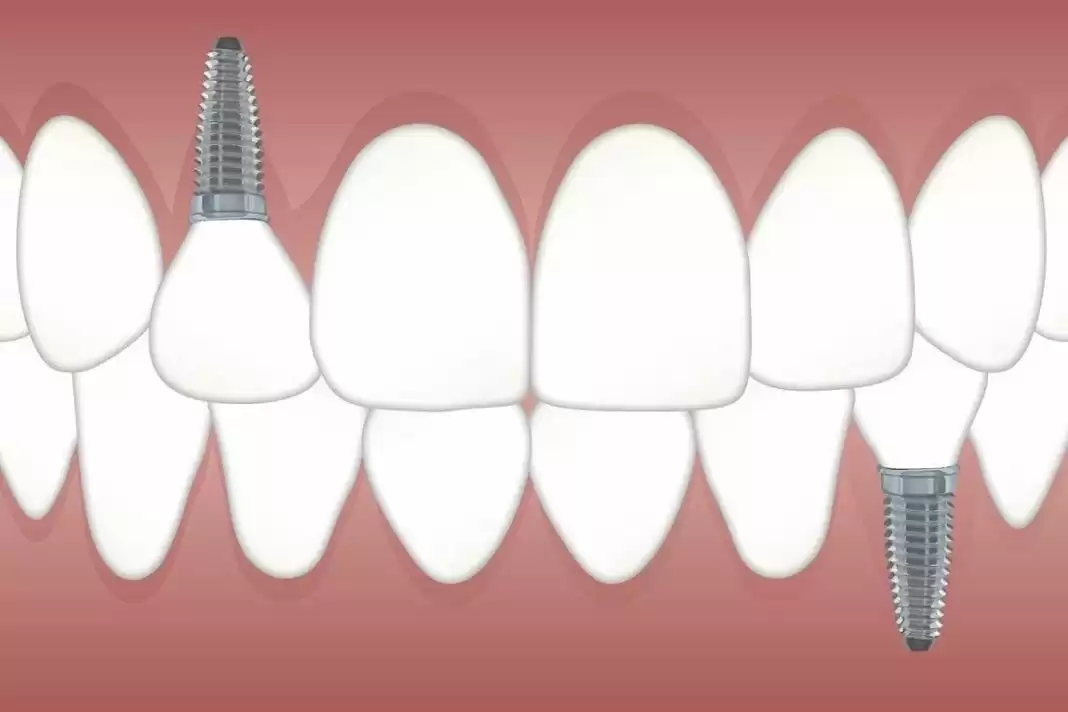 DentaTur