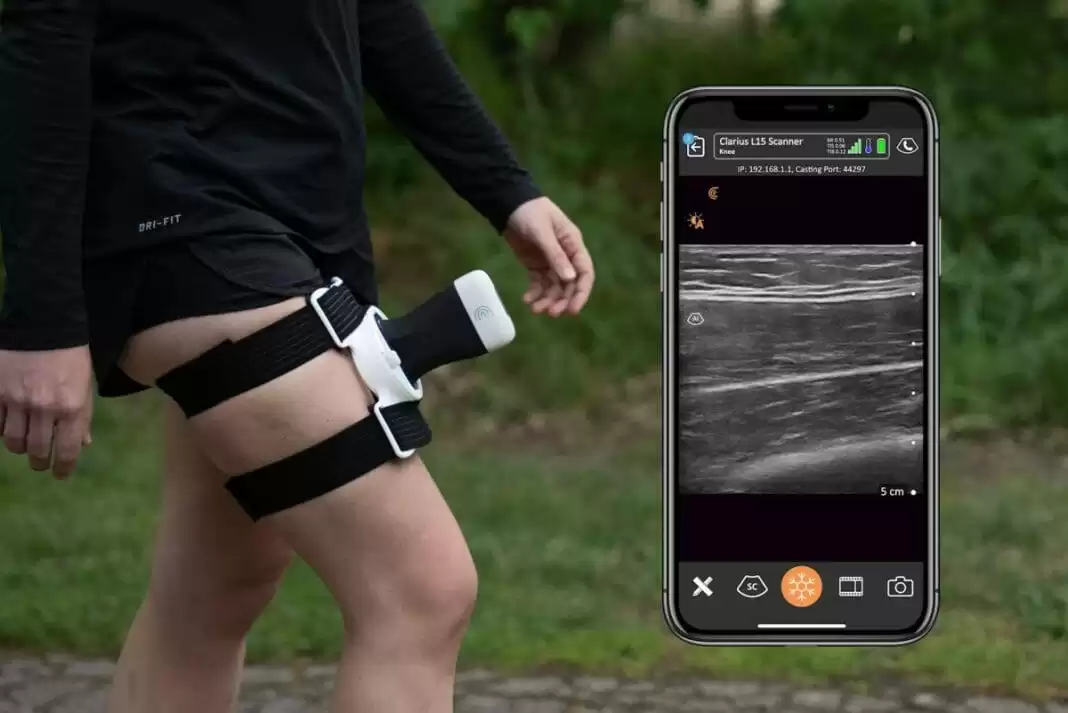 Wireless and Wearable Ultrasound Imaging