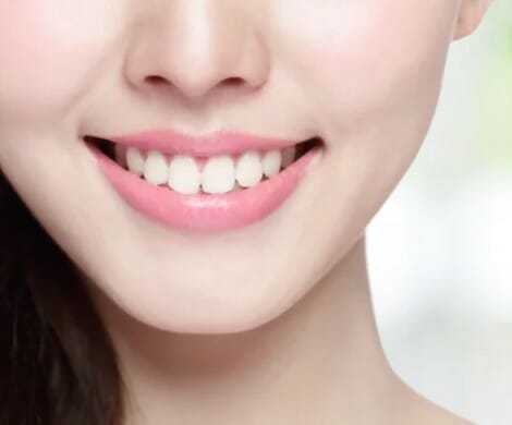 Cosmetic Dentistry in Whittier, CA