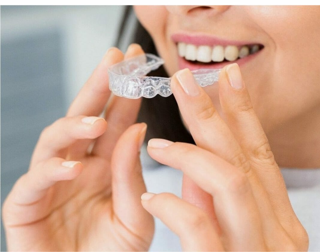 Invisalign in San Diego