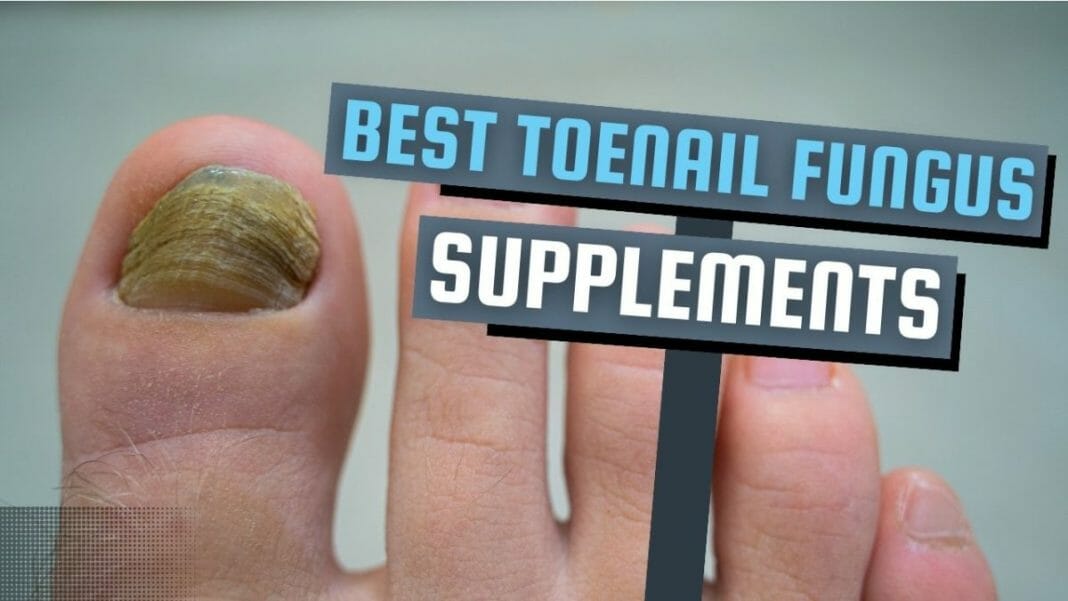 Toenail Fungus Supplement