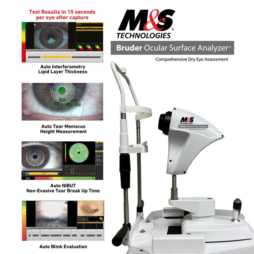 M&S Bruder Ocular Surface Analyzer