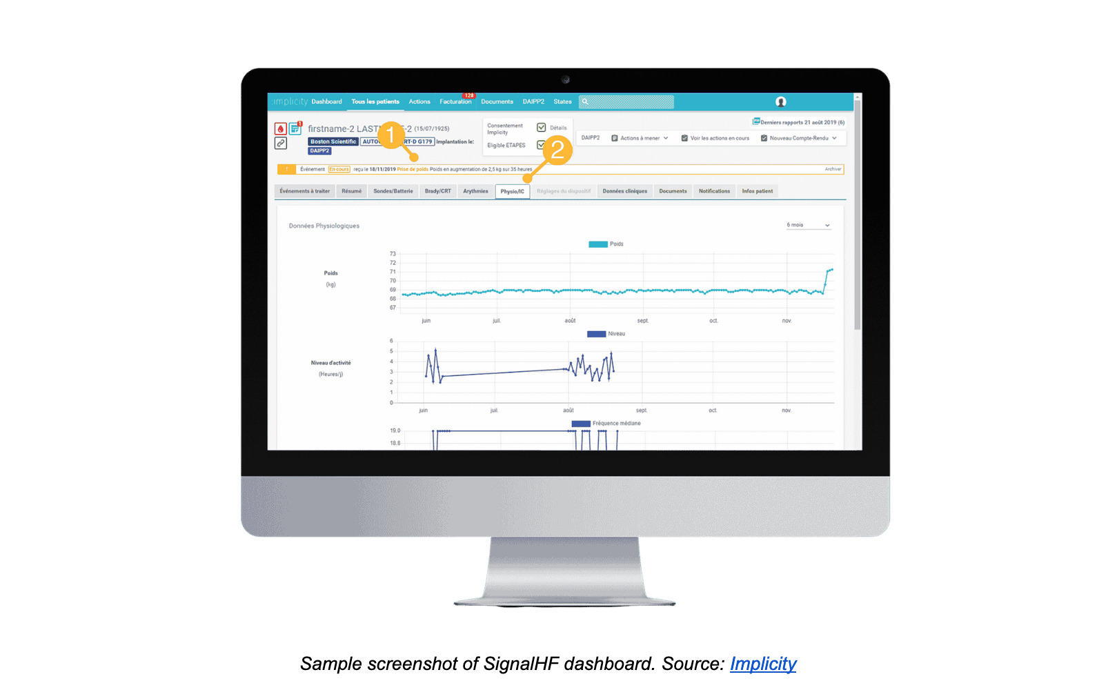 SignalHF dashboard. Source: Implicity 