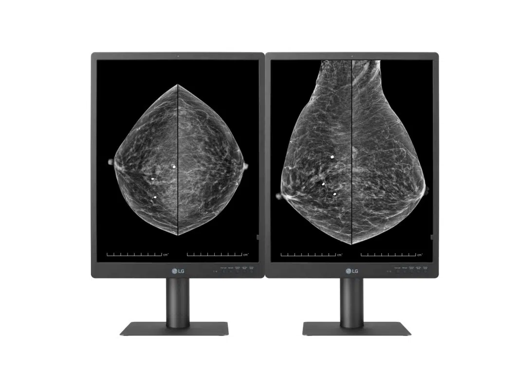 LG Launches 5MP Diagnostic Monitor for Breast Imaging