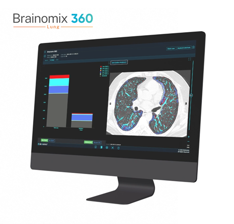 Brainomix