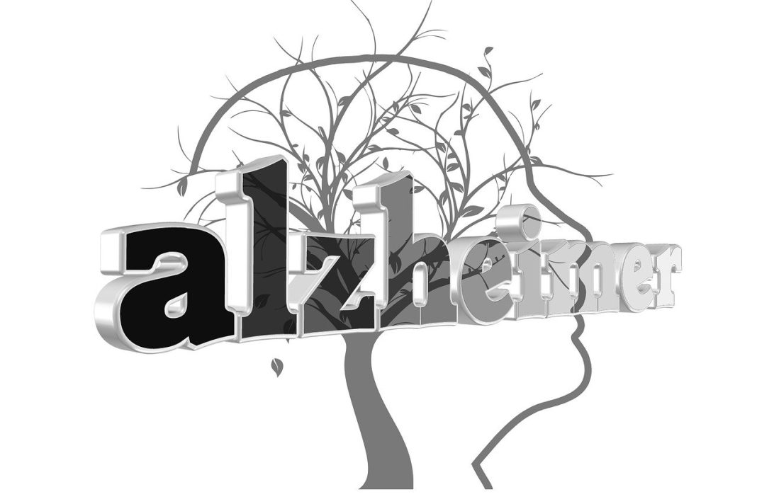 Alzheimer’s